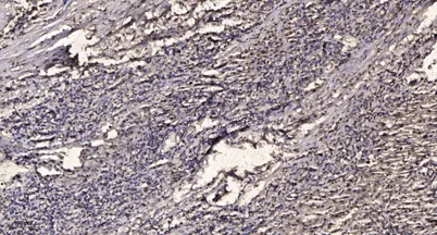 Smad2 (phospho Ser465) rabbit pAb