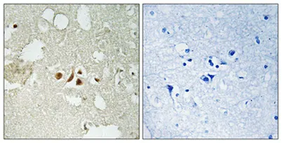 Smad2 (phospho Thr220) rabbit pAb - image 1