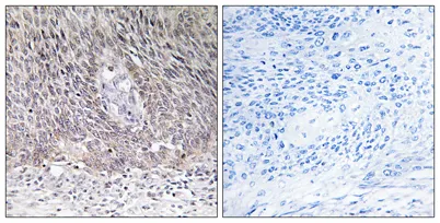Arylsulfatase A rabbit pAb - image 1