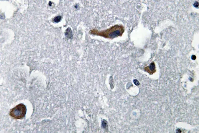 MAP-2 rabbit pAb - image 1