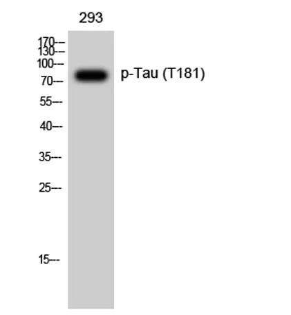Tau (phospho Thr181) rabbit pAb