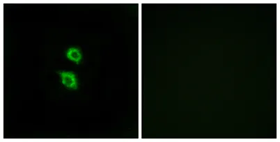 Arylsulfatase D rabbit pAb - image 1
