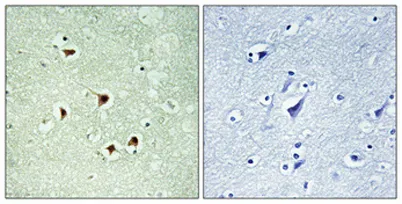 Max (phospho Ser2) rabbit pAb - image 1