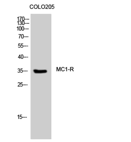 MC1-R rabbit pAb - image 1