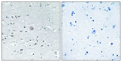 Arylsulfatase F rabbit pAb - image 1
