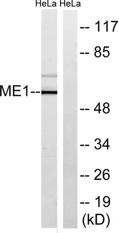 Malic enzyme 1 rabbit pAb - image 1