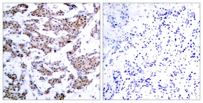 MEF-2 (phospho Thr312) rabbit pAb - image 1