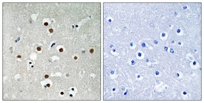 MEF-2C (phospho Ser396) rabbit pAb - image 1