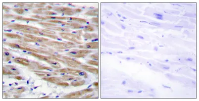MEK Kinase-4 rabbit pAb - image 1