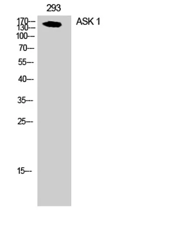 ASK 1 rabbit pAb - image 1
