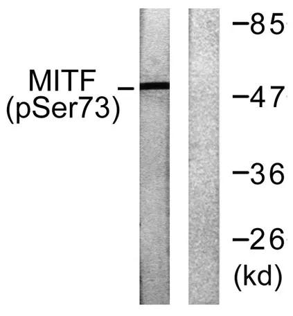 MITF (phospho Ser180) rabbit pAb