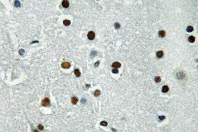 ASCL1 rabbit pAb - image 1
