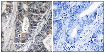 MLK1 rabbit pAb - image 1