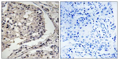 MLK1/2 rabbit pAb - image 1