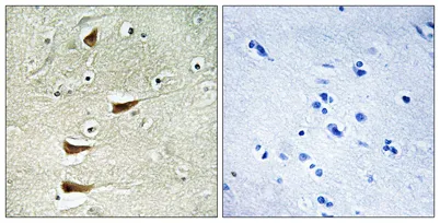 MLK2 rabbit pAb - image 1