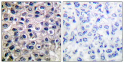 MMP-14 rabbit pAb - image 1