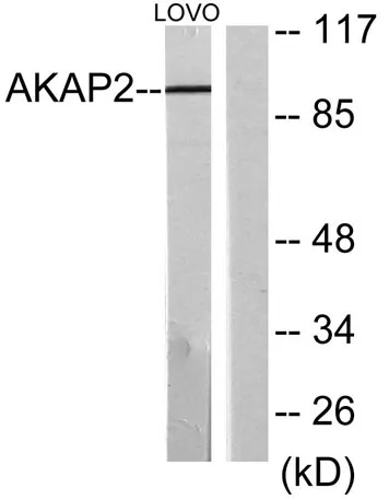 AKAP 2 rabbit pAb - image 1
