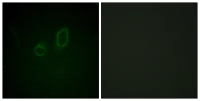 Moesin/Ezrin/Radixin (phospho Thr558) rabbit pAb