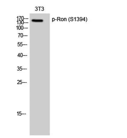 Ron (phospho Ser1394) rabbit pAb