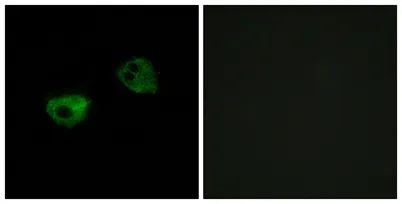 MEL-1A-R rabbit pAb - image 1