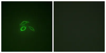 Mucin 1 (phospho Tyr1229) rabbit pAb