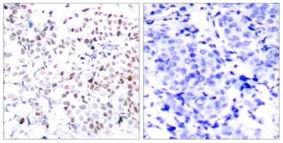 c-Myc (phospho Thr358) rabbit pAb - image 1