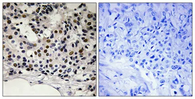 Myf-5 (phospho Ser49) rabbit pAb