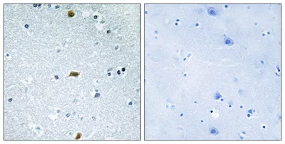 ATBF1 rabbit pAb