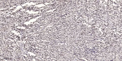 MYLK (phospho Tyr464) rabbit pAb