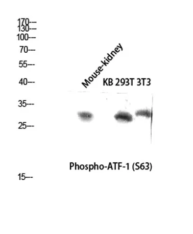 ATF-1 (phospho Ser63) rabbit pAb - image 1