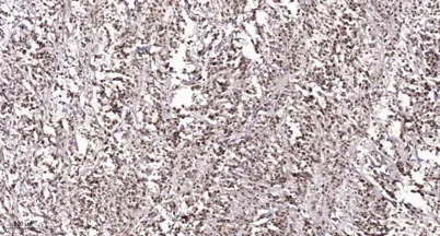 NACA (phospho Ser43) rabbit pAb