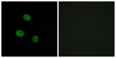 hnRNP M rabbit pAb - image 1