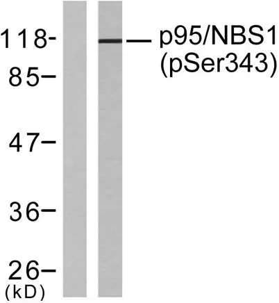 Nibrin (phospho Ser343) rabbit pAb - image 1