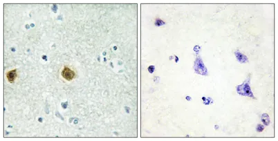 NDUFC2 rabbit pAb - image 1