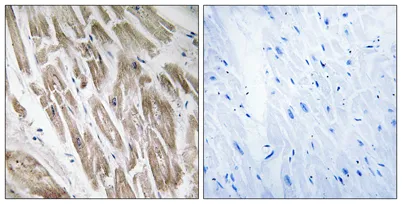 NDUFS5 rabbit pAb - image 1