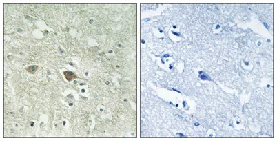 NDUFV3 rabbit pAb - image 1