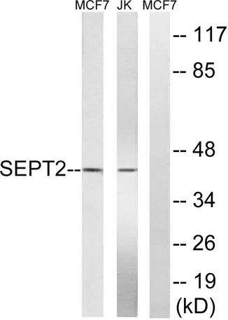 Septin 2 rabbit pAb - image 1