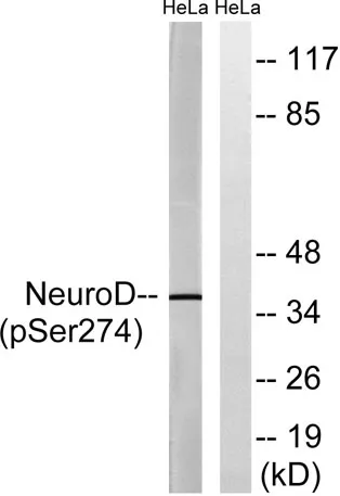 Neuro D (phospho Ser274) rabbit pAb - image 1