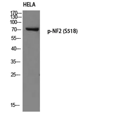 NF2 (phospho Ser518) rabbit pAb - image 1