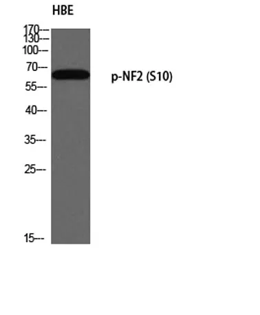 NF2 (phospho Ser10) rabbit pAb - image 1