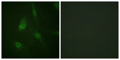 NFATc3 (phospho Ser165) rabbit pAb - image 1