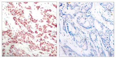 NFκB-p100 (phospho Ser865) rabbit pAb - image 1