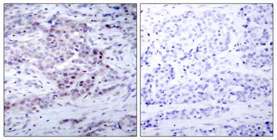 NFκB-p100 (phospho Ser869) rabbit pAb - image 1