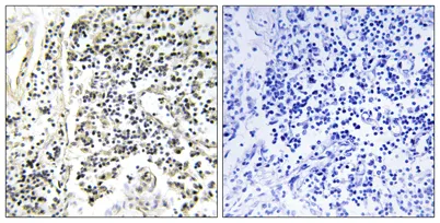 IκB-α (phospho Tyr305) rabbit pAb - image 1