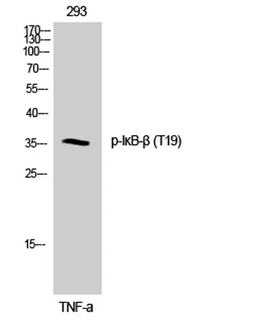 IκB-β (phospho Thr19) rabbit pAb - image 1