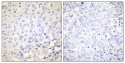 IκB-ε (phospho Ser22) rabbit pAb - image 1