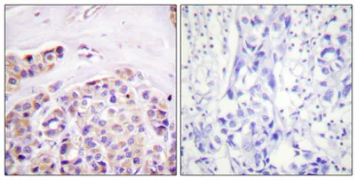 IκB-ε rabbit pAb - image 1