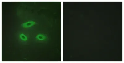 NK-TR rabbit pAb - image 1