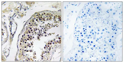 CNOT4 rabbit pAb - image 1