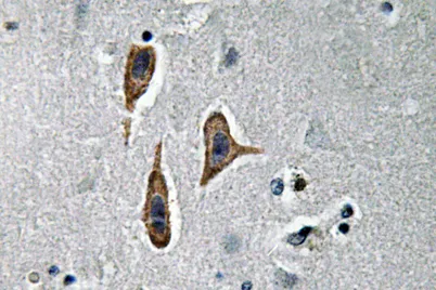 Nephrin rabbit pAb